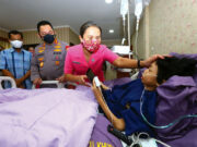 Penuhi Janji, Kapolri Jenguk Sinta Aulia Anak yang Sakit Tumor Kaki