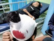 Asep NS : Saya Harap Polisi Serius Tangani LP Pembacokan di Ujungberung